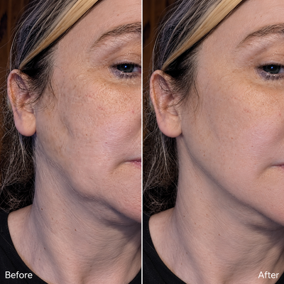 Lymphara® Lymphatic Drainage Drops